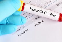 hepatitis C testing