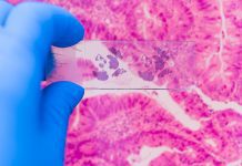 Spread of triple-negative breast cancer fuelled by softer tumours cancer cells