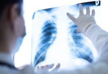 The impact of socioeconomic status on lung cancer screening participation The impact of socioeconomic status on lung cancer screening participation