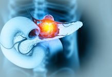 Trial demonstrates ARM-002TM vaccine’s effectiveness against pancreatic cancer ARM-002TM vaccine shows effectiveness against pancreatic cancer