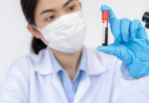 Blood test and AI could predict Parkinson’s disease