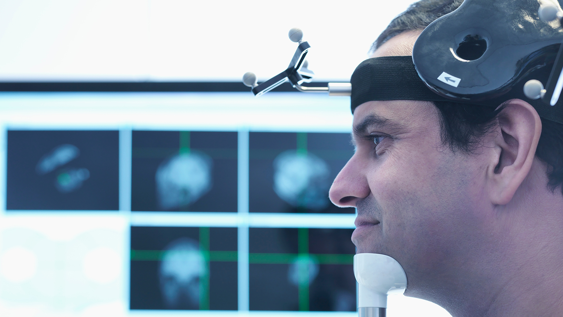 Could personalised transcranial magnetic stimulation revolutionise depression treatment?