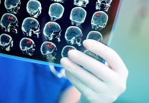 Wearable brain scanner provides the clearest picture yet of developing brains Wearable brain imaging provides the clearest picture yet of children's developing brains