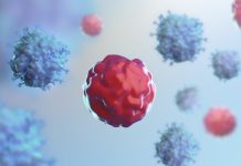 Achieving CAR T-cell therapy health system readiness