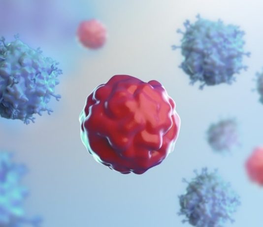 Achieving CAR T-cell therapy health system readiness